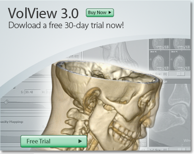 VolView 3.0 for Mac allows medical doctors and researchers 3D volume rendering capabilities with GPU hardware acceleration.